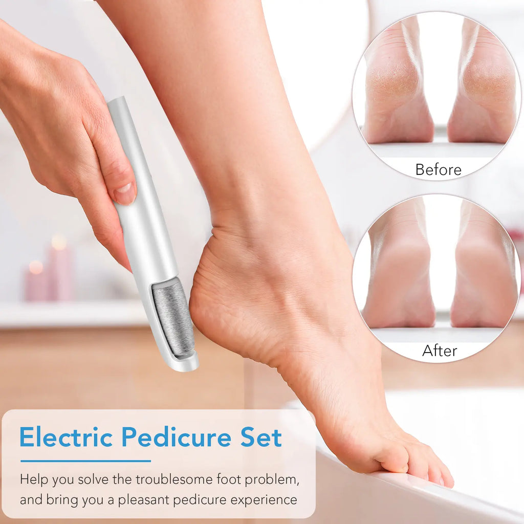 PediSmooth Pro - Electric Foot File & Callus Remover