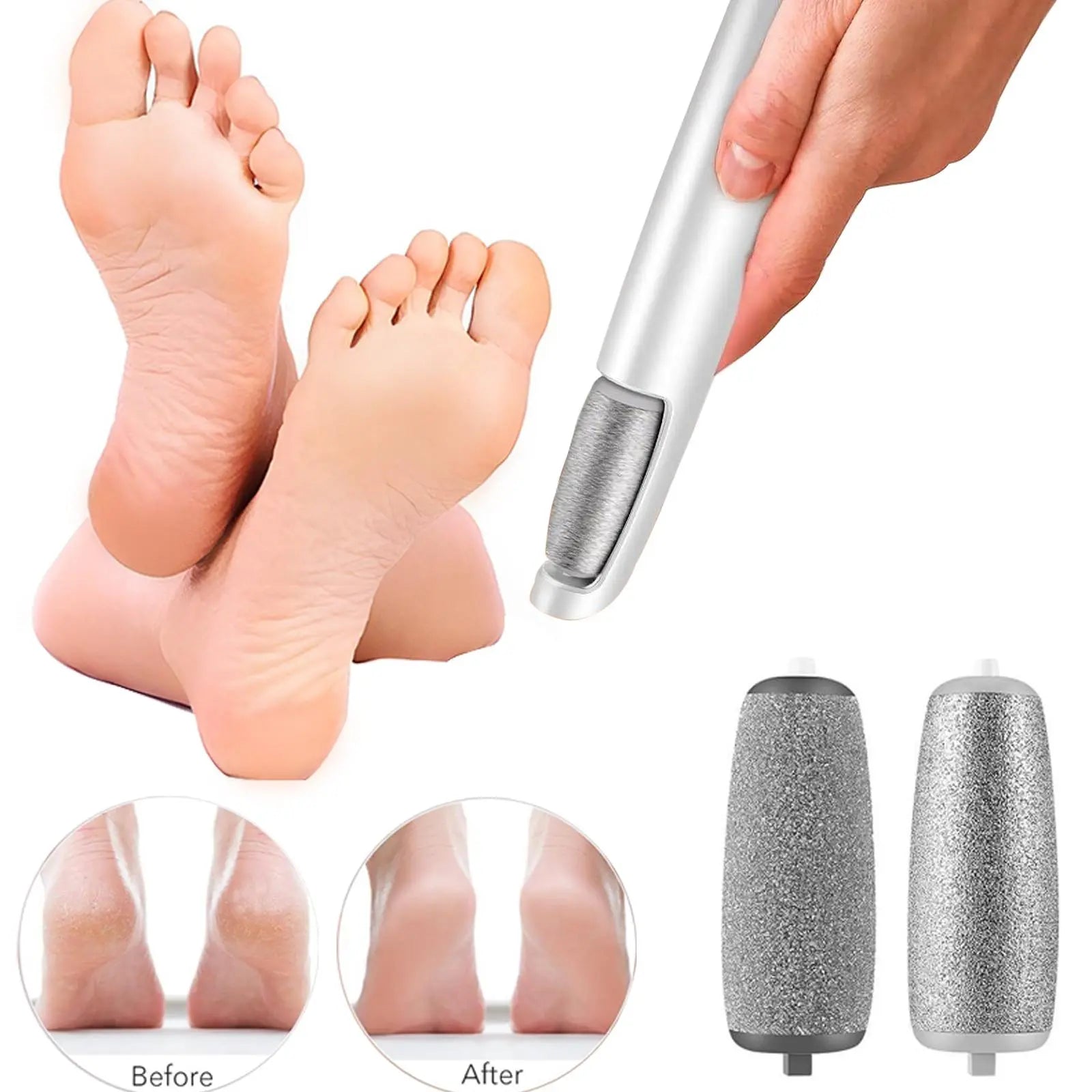PediSmooth Pro - Electric Foot File & Callus Remover